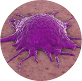 Síndrome de lisis tumoral