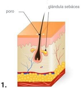 Fotos y etapas del acne
