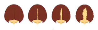 Signos