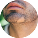 Falta de pelo en barba o cejas