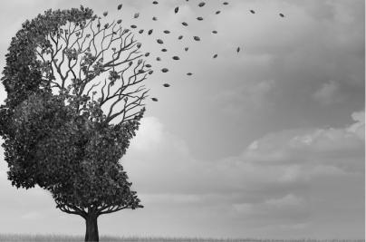 ¿Qué es el alzheimer?