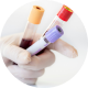 Prueba de sangre cualitativa