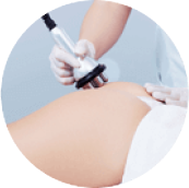 Radiofrecuencias de aspiración rítmica