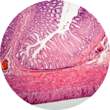 La pérdida de sangre por el recto