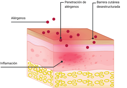 Dermatitis skin