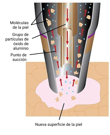 Eliminación de piel muerta
