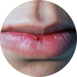 Labios azulados