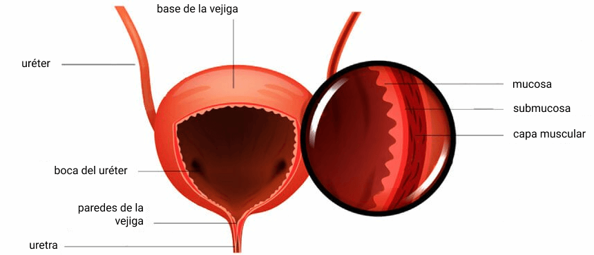 incontinencia urinaria