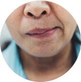 Parálisis facial, de la pierna o el brazo