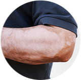 Manchas y decoloraciones