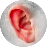 Secreción de líquido o pus en el oído