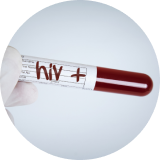 Están infectadas de VIH