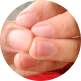 Sensación de espasmo que que se irriga hacia los dedos