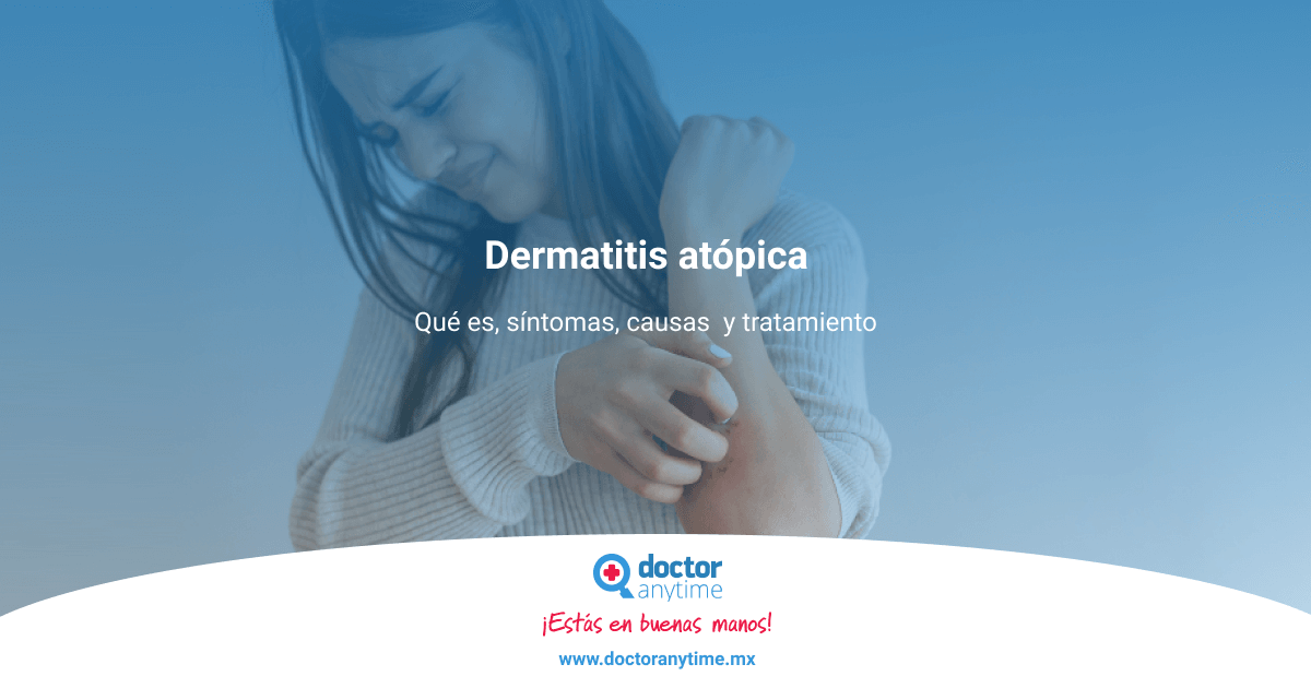 Dermatitis Atópica Cómo Tratarla Y Cómo Cuidar La Piel 7763