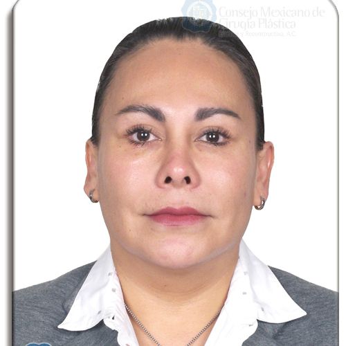 Dra. Marisol Rosas Ramos, Cirujano Plastico en Gustavo A. Madero | Agenda una cita online